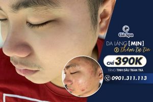 Dịch vụ trị mụn chuyên sâu 8 bước