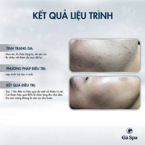 Review Khách Hàng Hải Tảo Vi Sinh (11/1/2019)